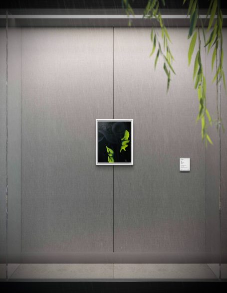 lat. ARTERIA CAROTIS INTERNA lat. ARTERIA CAROTIS INTERNA