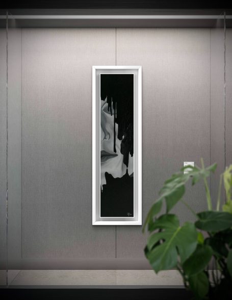 PATIENT N°1 PATIENT N°1